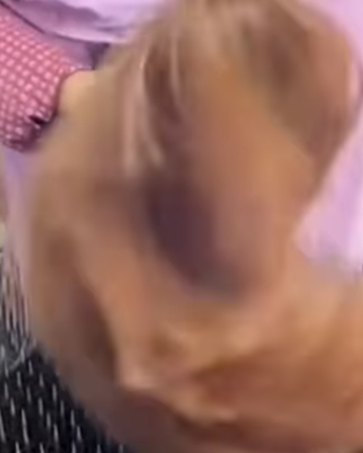Hair